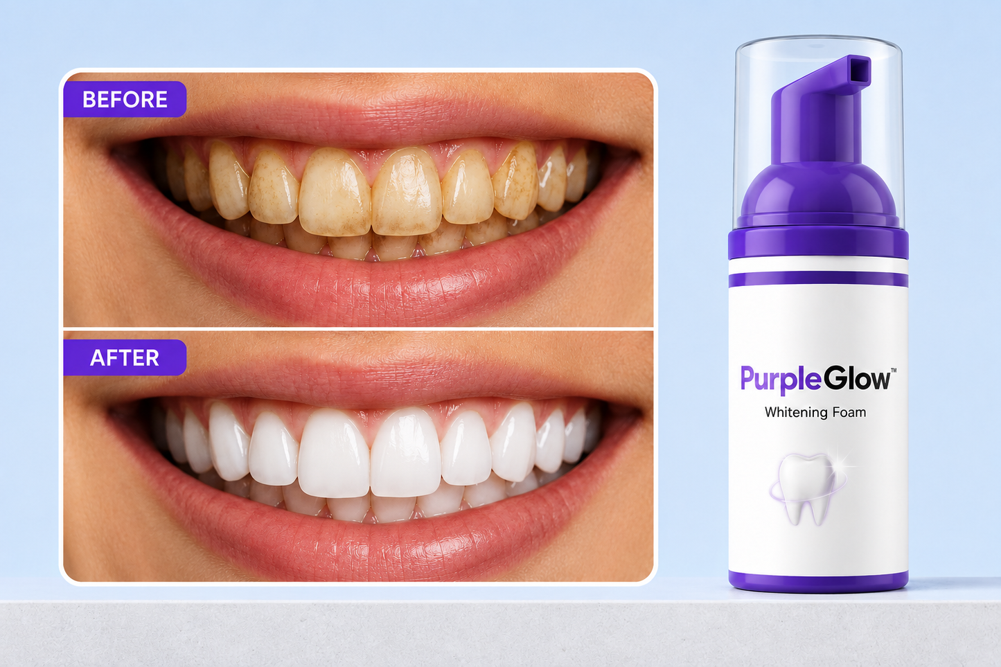 PurpleGlow™ Teeth Whitening Foam